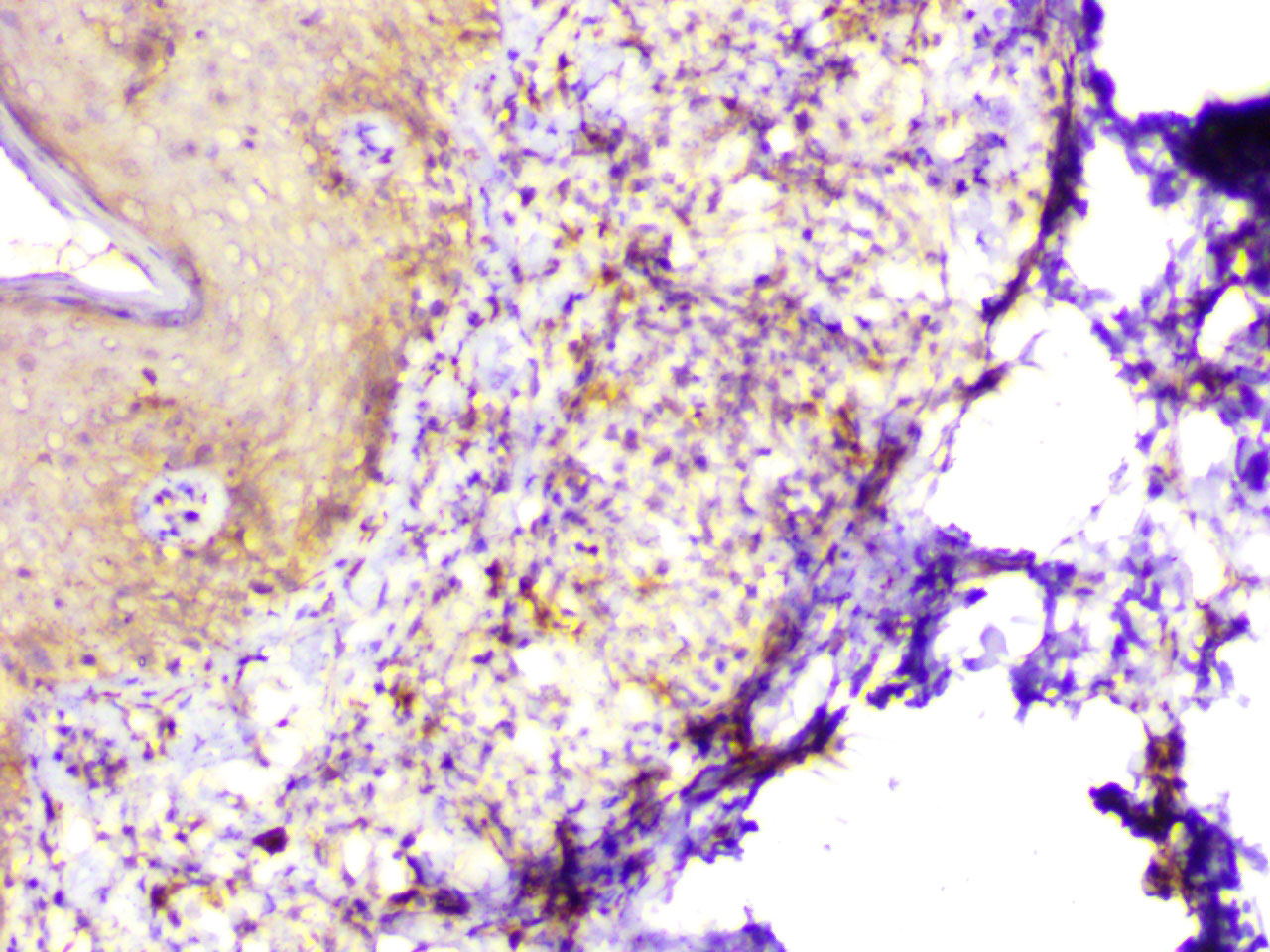 ihc14