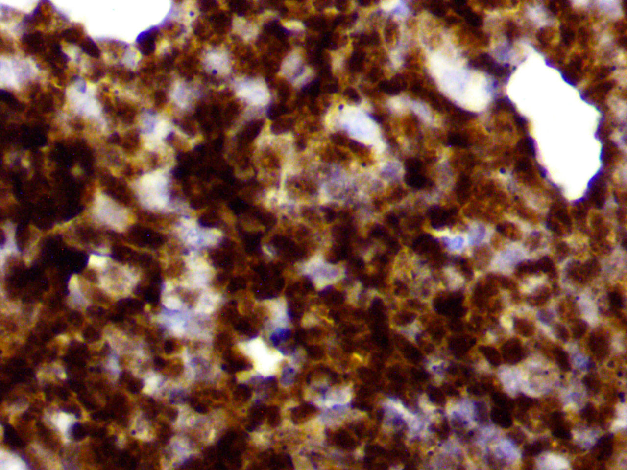 ihc20