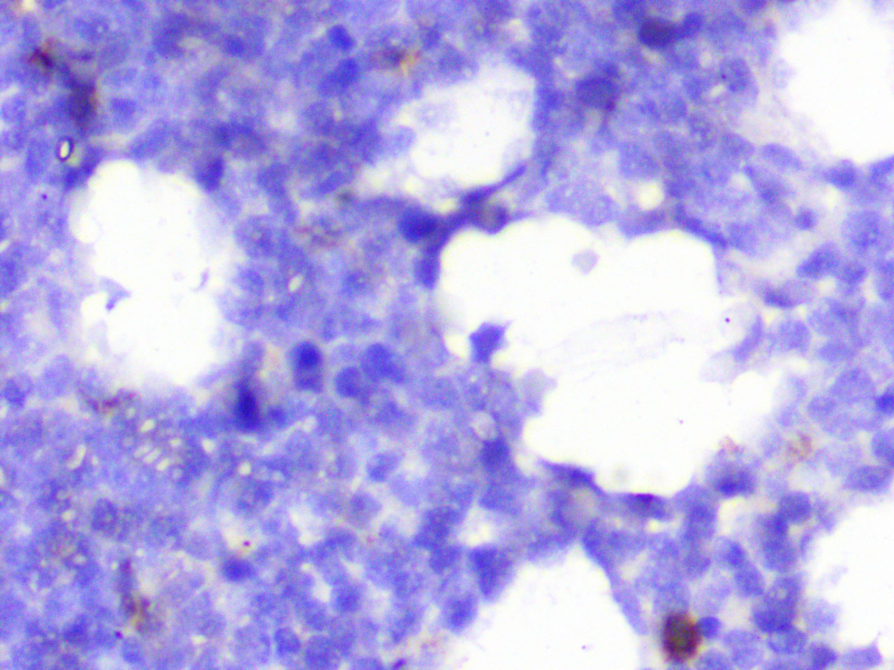 ihc6