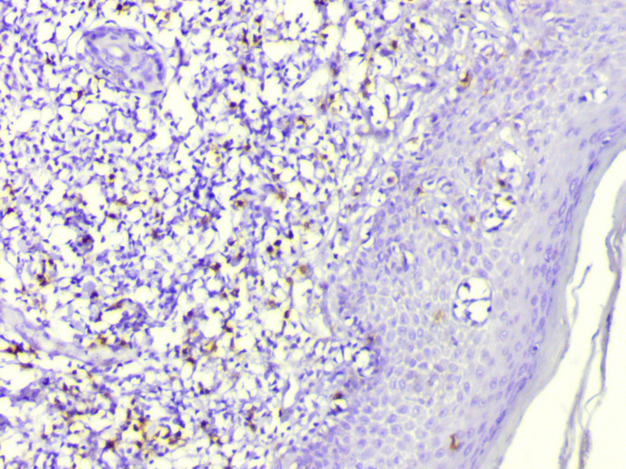 ihc8