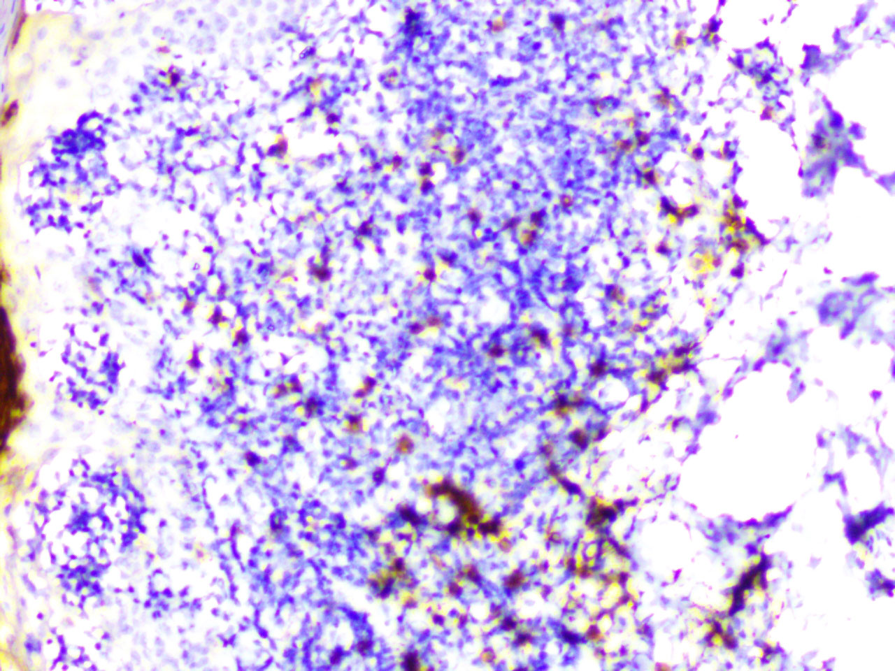 ihc9